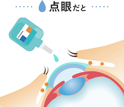【小林製薬アイボン@日本からのお土産で嬉しかったもの】 【小林製薬アイボン@日本からのお土産で嬉しかったもの】